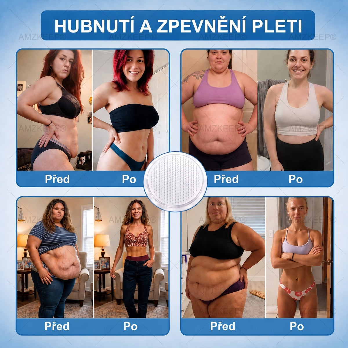 🇨🇿𝐀𝗠𝒁𝑲𝗘𝑬𝙋® 𝐀𝗠𝗣𝑲𝐌𝗼𝗿𝗶𝗻𝗴𝗮𝐁𝗲𝗿𝗯𝗲𝗿𝗶𝗻𝗲 𝟏𝟎-𝗶𝗻-𝟏 𝐌𝗲𝘁𝗮𝗯𝗼𝗹𝗶𝗰 𝐒𝘂𝗽𝗽𝗼𝗿𝘁 𝐍𝗮𝗻𝗼 𝐌𝗶𝗰𝗿𝗼𝗻𝗲𝗲𝗱𝗹𝗲 𝐏𝗮𝘁𝗰𝗵 (𝗝𝗲𝗱𝗻𝗼𝘂 𝗱𝗲𝗻𝗻ě, 𝗩𝗶𝗱𝗶𝘁𝗲𝗹𝗻é 𝘃ý𝘀𝗹𝗲𝗱𝗸𝘆 𝘇𝗮 𝟳 𝗱𝗻í)✅ 𝗣𝗿𝗼 𝗻𝗮𝗱𝘃á𝗵𝘂, 𝘂𝘃𝗼𝗹𝗻ě𝗻𝗼𝘂 𝗸ůž𝗶, 𝗱𝗶𝗮𝗯𝗲𝘁𝗲𝘀, 𝘀𝗽á𝗻𝗸𝗼𝘃𝗼𝘂 𝗮𝗽𝗻𝗼𝗲, 𝗽𝗿𝗼𝗯𝗹é𝗺𝘆 𝘀 𝗸𝗹𝗼𝘂𝗯𝘆 𝗮 𝗱𝗮𝗹ší