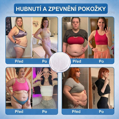 🇨🇿𝐀𝗠𝒁𝑲𝗘𝑬𝙋® 𝐀𝗠𝗣𝑲𝐌𝗼𝗿𝗶𝗻𝗴𝗮𝐁𝗲𝗿𝗯𝗲𝗿𝗶𝗻𝗲 𝟏𝟎-𝗶𝗻-𝟏 𝐌𝗲𝘁𝗮𝗯𝗼𝗹𝗶𝗰 𝐒𝘂𝗽𝗽𝗼𝗿𝘁 𝐍𝗮𝗻𝗼 𝐌𝗶𝗰𝗿𝗼𝗻𝗲𝗲𝗱𝗹𝗲 𝐏𝗮𝘁𝗰𝗵 (𝗝𝗲𝗱𝗻𝗼𝘂 𝗱𝗲𝗻𝗻ě, 𝗩𝗶𝗱𝗶𝘁𝗲𝗹𝗻é 𝘃ý𝘀𝗹𝗲𝗱𝗸𝘆 𝘇𝗮 𝟳 𝗱𝗻í)✅ 𝗣𝗿𝗼 𝗻𝗮𝗱𝘃á𝗵𝘂, 𝘂𝘃𝗼𝗹𝗻ě𝗻𝗼𝘂 𝗸ůž𝗶, 𝗱𝗶𝗮𝗯𝗲𝘁𝗲𝘀, 𝘀𝗽á𝗻𝗸𝗼𝘃𝗼𝘂 𝗮𝗽𝗻𝗼𝗲, 𝗽𝗿𝗼𝗯𝗹é𝗺𝘆 𝘀 𝗸𝗹𝗼𝘂𝗯𝘆 𝗮 𝗱𝗮𝗹ší