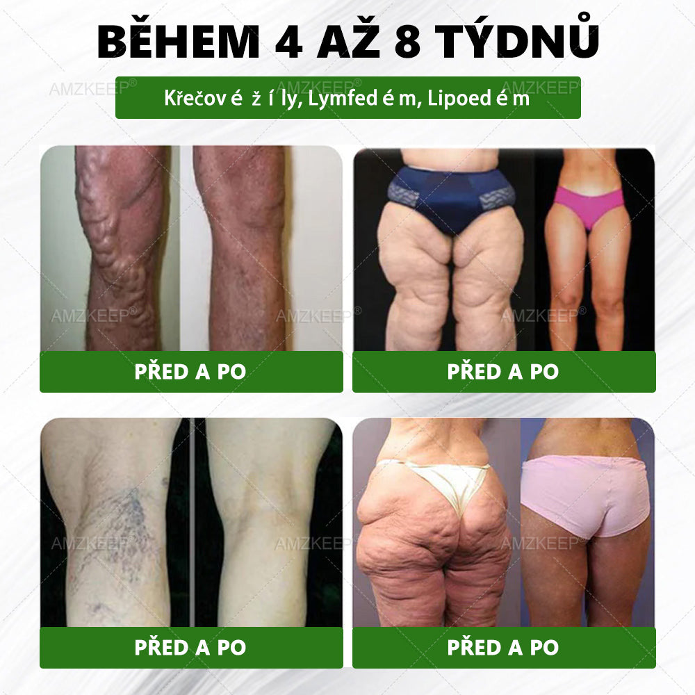 🇨🇿𝐋é𝐤𝐚ř𝐞𝐦 𝐟𝐨𝐫𝐦𝐮𝐥𝐨𝐯𝐚𝐧ý 𝐀𝐌𝐙𝐊𝐄𝐄𝐏® 𝐌𝐨𝐫𝐢𝐧𝐠𝐚 𝐁𝐞𝐫𝐛𝐞𝐫𝐢𝐧 × 𝐍𝐀𝐃+ 𝟏𝟎-𝐢𝐧-𝟏 𝐏𝐨𝐤𝐫𝐨č𝐢𝐥á 𝐍𝐚𝐧𝐨 𝐌𝐢𝐤𝐫𝐨𝐧𝐞𝐞𝐝𝐥𝐞 𝐍á𝐩𝐥𝐚𝐬𝐭 (𝐙𝐚ž𝐢𝐣𝐭𝐞 𝐯𝐢𝐝𝐢𝐭𝐞𝐥𝐧é 𝐯ý𝐬𝐥𝐞𝐝𝐤𝐲 𝐣𝐢ž 𝐳𝐚 𝟕 𝐝𝐧í)