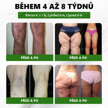 🇨🇿𝐋é𝐤𝐚ř𝐞𝐦 𝐟𝐨𝐫𝐦𝐮𝐥𝐨𝐯𝐚𝐧ý 𝐀𝐌𝐙𝐊𝐄𝐄𝐏® 𝐌𝐨𝐫𝐢𝐧𝐠𝐚 𝐁𝐞𝐫𝐛𝐞𝐫𝐢𝐧 × 𝐍𝐀𝐃+ 𝟏𝟎-𝐢𝐧-𝟏 𝐏𝐨𝐤𝐫𝐨č𝐢𝐥á 𝐍𝐚𝐧𝐨 𝐌𝐢𝐤𝐫𝐨𝐧𝐞𝐞𝐝𝐥𝐞 𝐍á𝐩𝐥𝐚𝐬𝐭 (𝐙𝐚ž𝐢𝐣𝐭𝐞 𝐯𝐢𝐝𝐢𝐭𝐞𝐥𝐧é 𝐯ý𝐬𝐥𝐞𝐝𝐤𝐲 𝐣𝐢ž 𝐳𝐚 𝟕 𝐝𝐧í)